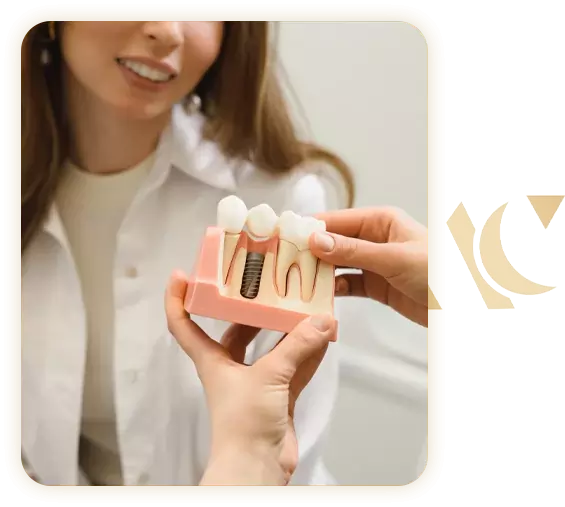 Implant dentaire Tunis
